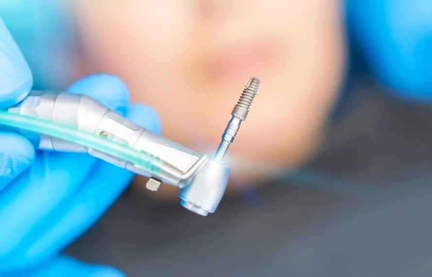 Chirurgie dentaire : il fait parfois y recourir