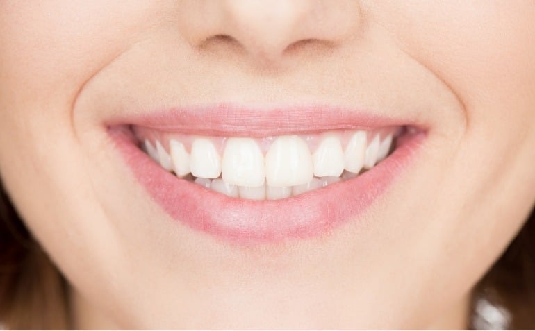 Couronne ou pont : un processus de restauration complet sous un même toit ! 