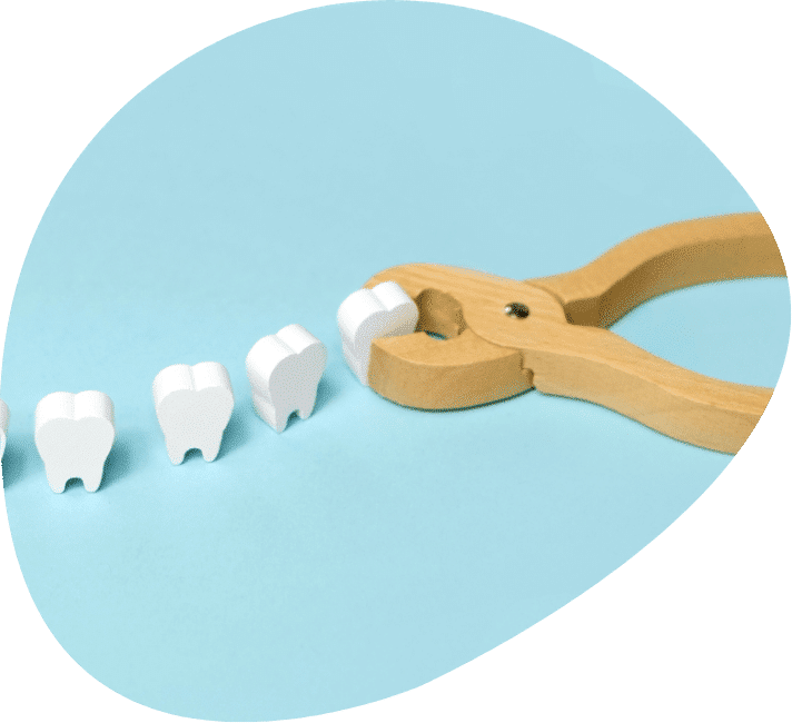 Dents de sagesse-extractions